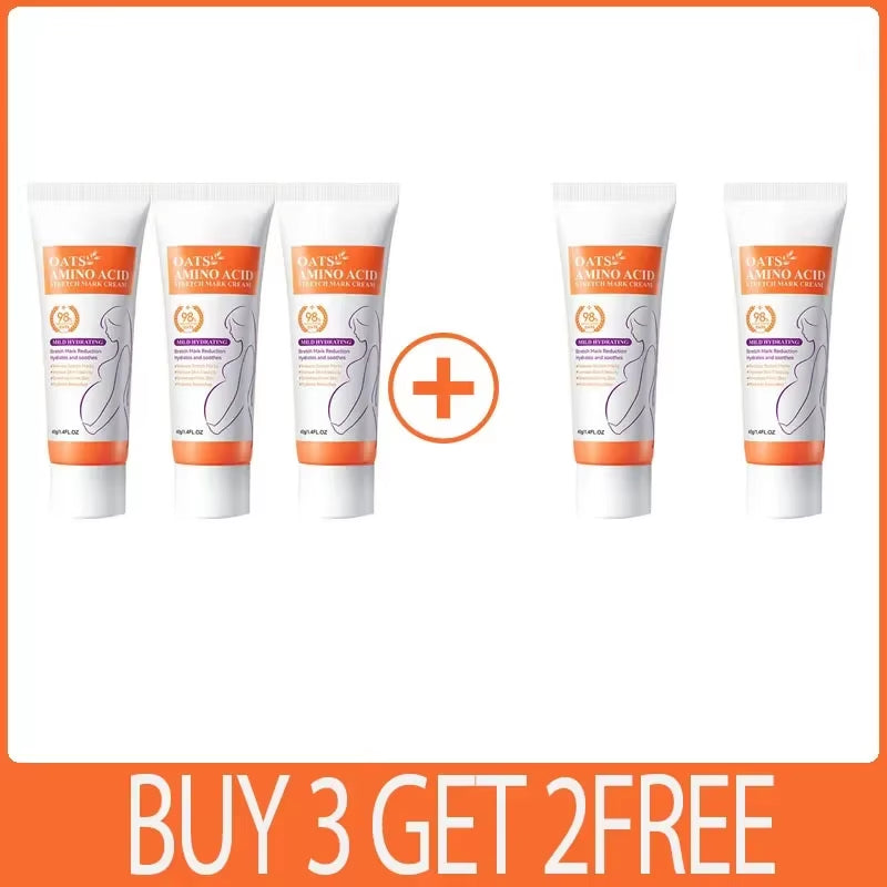 Stretch Marks Removal Cream Light Lines Postpartum Obesity Pregnancy Powerful Fast Absorption