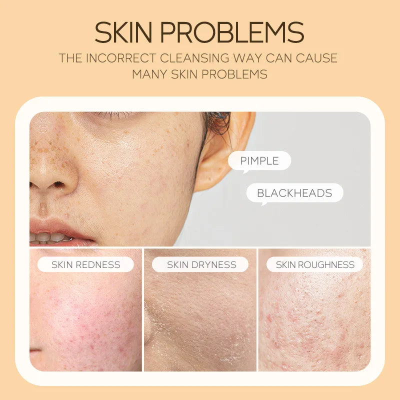 Vitamin C Cleansing Mousse Deep Clean Pores Oil Control Foaming Facial Cleanser Whitening Moisturizing Skin Care Product